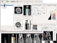 A combination SPECT/CT scan being shown in AMIDE