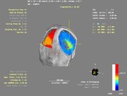 Atlas overlay