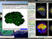 Biomedical modeling with ITKSnap, Meshlab and Netgen
