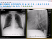 Magnifying lens to explore anatomy