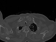 Using EasyBMP for medical image segmentation