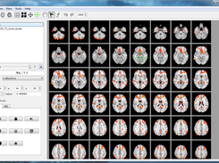 Display fMRI activation image as an overlay