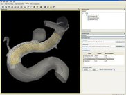 Stenting