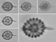 Microscopic images of Radiolarian diatom and fused image.