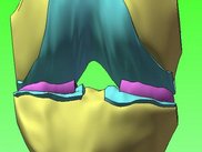 Modelo 3d Open-Knee