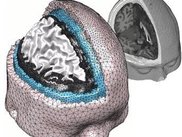 Colins human brain atlas mesh