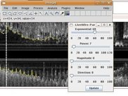 LiveWire ImageJ plugin in a longitudinal IVUS segmentation