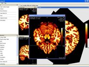 Nukak3D Medical Image Viewer, DICOM Support