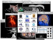 OsiriX