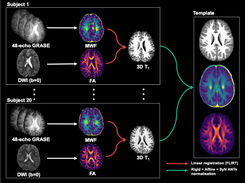 Pediatric MRI Myelin+ Diffusion Template - The atlas creation process