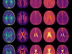 Pediatric MRI Myelin+Diffusion Atlas Screenshot 2