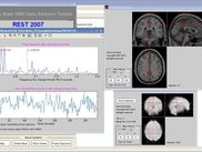 Power Spectrum with Slice Viewer