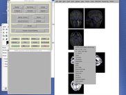 Context menu in CheckReg (spm_orthviews) with plugins