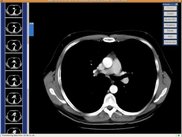 A series of TC images on the viewer