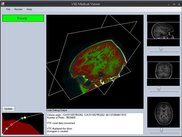 Colored plane view of MR head data