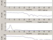 Amplitude spectra of measured results.