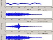Oscillograms of raw results.