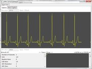 Online signal viewer
