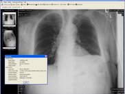 Chest X-Ray and Study Info Dialog