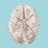Cerebrovascular Stroke: WTD