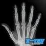 X-Ray Scanner