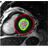 Evaluation of Cardiac MR Segmentation