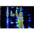 spectrograph