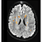 WM Hyperintensities Segmentation Toolbox