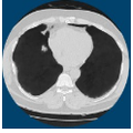 ClearRead Xray