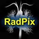 RadPix Reviews