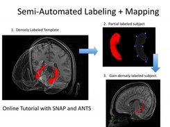 Semi-automated template based hippocampus labeling.