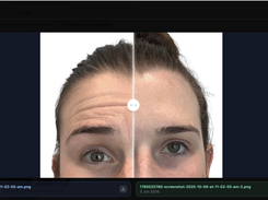 Before and After Photo Comparisons