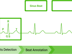 CardioAI Screenshot 3