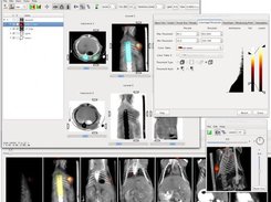 A combination SPECT/CT scan being shown in AMIDE