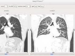 Showing off MPR, MIPS, and minip slab views.