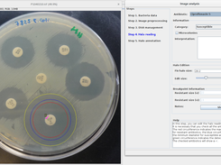 Detecting inhibition zones