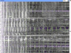 single audio track