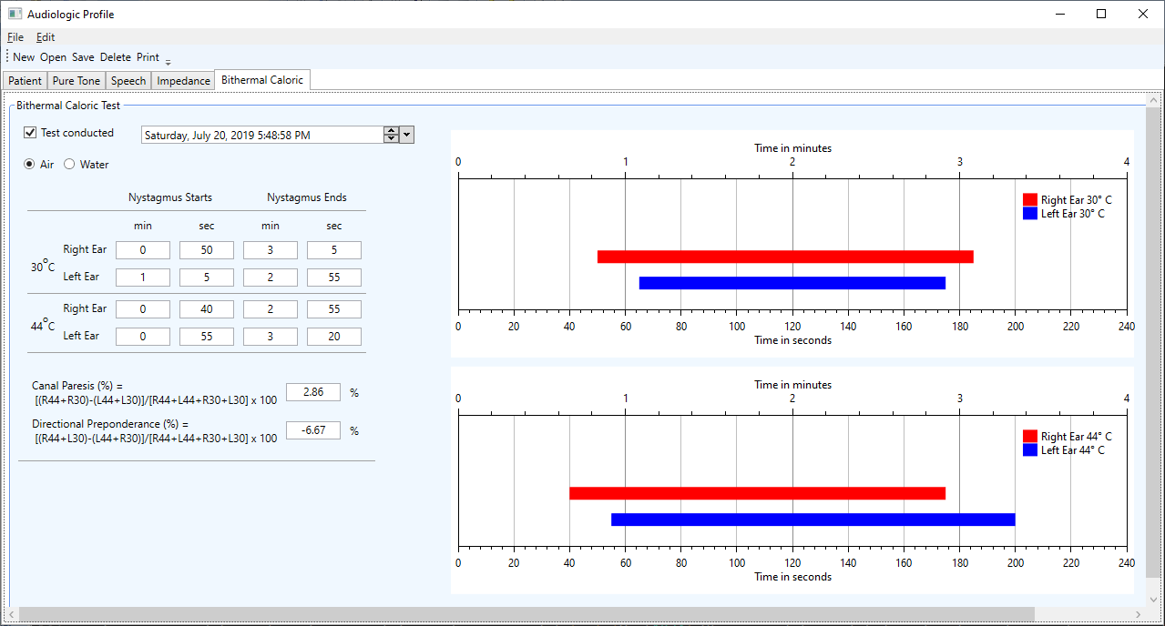 Hearing Test - Pure-tone audiometry on Android