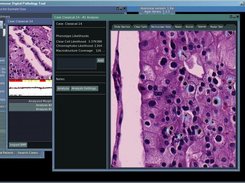 Examining an individual region of morphological analysis