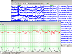 BioSigPlot Interface