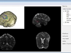 BrainLab（Complete）