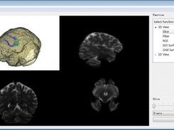 2D interaction(when you choose one point of one 2d image) 