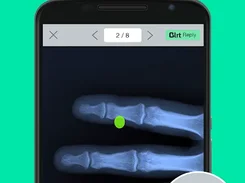 Blrt Screenshot 2