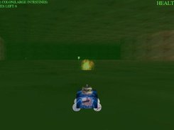 Stage 5: The large intestines (colon)