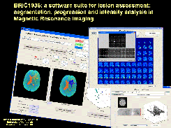 BRIC1936: a software suite for lesion assessment: segmentation, progression and intensity analysis, using magnetic resonance images