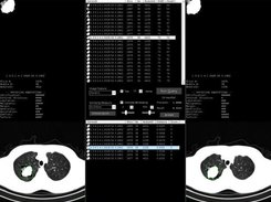 Nodule viewer