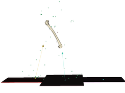 imaging gait fusion