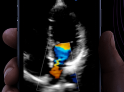 Butterfly Screenshot 1
