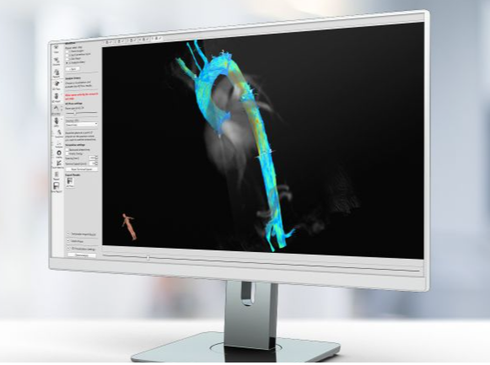 Caas MR 4D Flow Screenshot 1