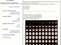 Report of Standard Space Mapping, shown on the MNI template